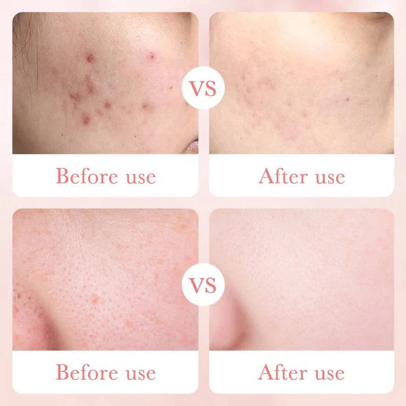 Bioaqua Rose Hyaluronic Acid Moisturizing Face Cream 50g
